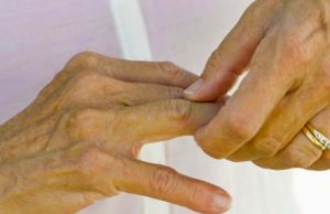 Kosti ne vole ovu hranu: Ako ovo jedete, bol je jači, artritis napreduje, zglobovi se troše…