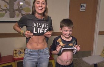 Medicinska sestra je donirala jetru 8-godišnjem dječaku!