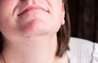 ZNATE LI ZAŠTO SE KOD ŽENA JAVLJAJU DLAČICE NA BRADI? Evo šta vam organizam govori