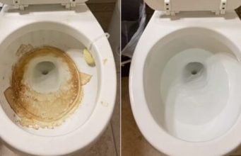 Nije sirće ni soda bikarbona: Ovo sredstvo najbolje uklanja kamenac u WC šolji