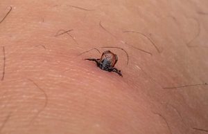 Kako pravilno da uklonite krpelja, bez odlaska kod ljekara? Nikako ga ne premazujte ovim!