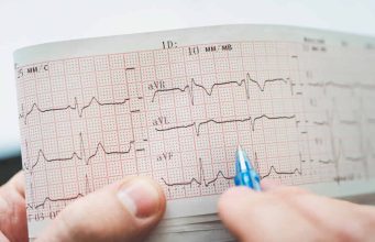Da li vam srce radi kako treba: Poznati kardiolog kaže da od 220 oduzmete ovaj broj