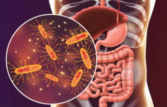 4 potpuno prirodna napitka koja najbolje čiste debelo crijevo od svih otrova i poboljšavaju varenje: Preporuka gastroenterologa